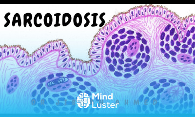 SARCOIDOSIS II RESPIRATORY SYSTEM II SIMPLY PATHOLOGY II PATHOLOGY LECTURES II