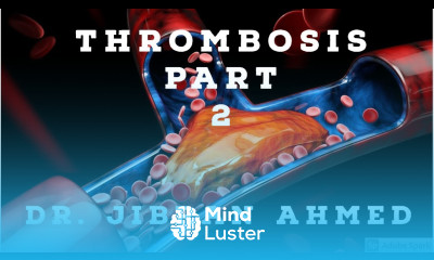 GENERAL PATHOLOGY II THROMBOSIS II PART 2 II CHAP 4 II ROBBINS 10TH EDITION