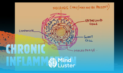 GENERAL PATHOLOGY II CHAPTER 3 II INFLAMMATION II CHRONIC INFLAMMATION II ROBBINS 10TH EDITION II