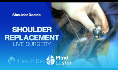 Shoulder Replacement Surgery Shoulder Arthroplasty Live Surgery
