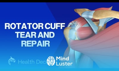 Rotator Cuff Tear and Surgical Repair 3D Animation