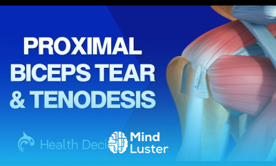 Proximal Biceps Tear and Biceps Tenodesis Restoring Function and Relieving Pain 3D Animation