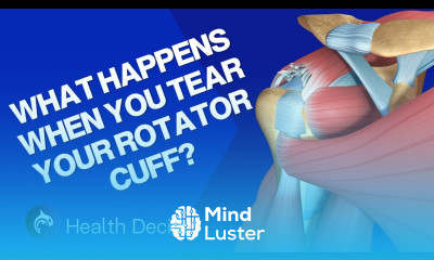 Rotator Cuff Tear and Surgical Repair 3D Animation