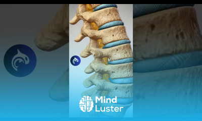 Learn about Hip Bursitis hip bursitis orthopedicsurgeon