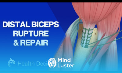 Distal Biceps Rupture and Surgical Repair 3D Animation