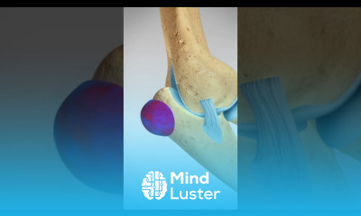 Triceps Tendon Avulsion and Repair elbowpainrelief elbowpain