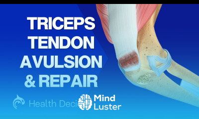 Triceps Tendon Avulsion and Repair Rare but Serious