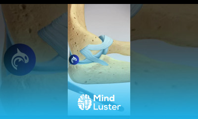 See how an Elbow Olecranon Fracture is Repaired 3D Animation