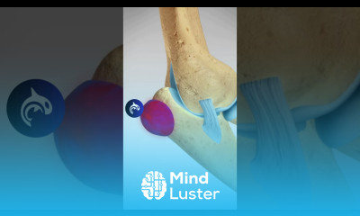 Triceps Tendon Avulsion and Surgical Repair triceps weightlifting