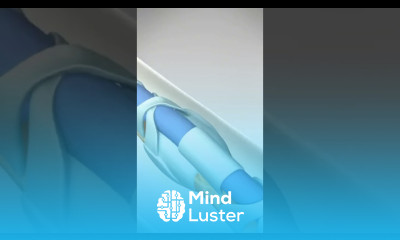 Do you know what a Jersey Finger is Flexor Tendon Injury and Surgery brokenfinger fingerfracture