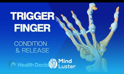 Understanding Trigger Finger See the Condition and Surgery 3D Animation