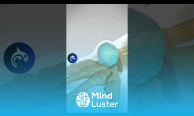 Bible Bump Ganglion Cyst When the Old Treatment was Slamming Your Hand with a Bible