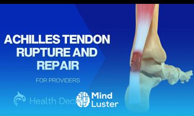 Achilles Tendon Rupture and Repair 3D Animation No Narration
