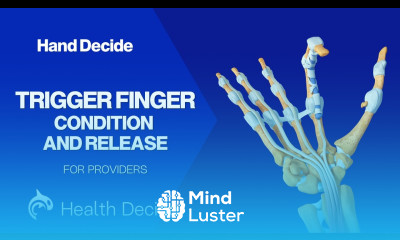 Trigger Finger Condition and Release 3D Animation No Narration