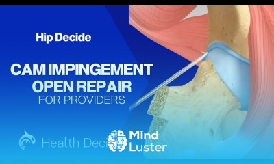 Cam Impingement Open Repair 3D Animation No Narration