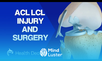 ACL Anterior Cruciate Ligament LCL Lateral Collateral Ligament Tear and Repair 3D Animation