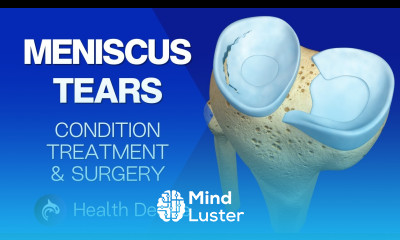 Meniscus Tears Condition Treatment and Surgery 3D Animation