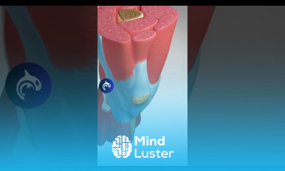 Meniscus Tear A very common knee injury that affects all ages knee meniscus 3d