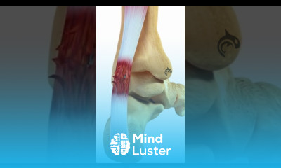 See how an Achilles Tendon Rupture is repaired