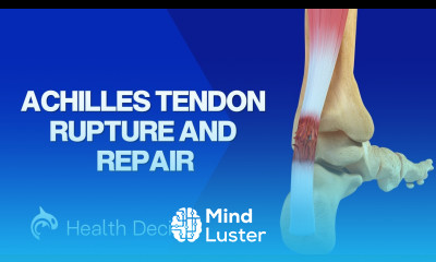 See What Happens in an Achilles Tendon Rupture and Repair 3D Animation
