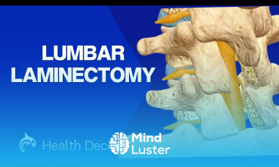 Lumbar Laminectomy 3D Animation