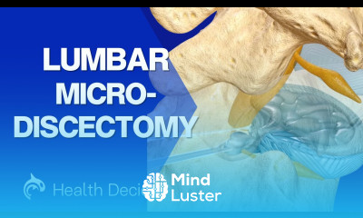 Lumbar Microdiscectomy 3D Animation