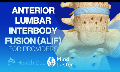 Anterior Lumbar Interbody Fusion ALIF 3D Animation No Narration