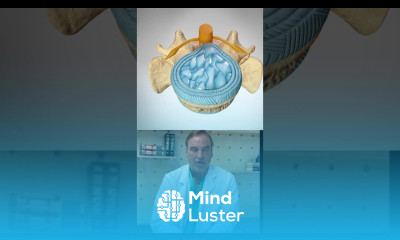 An Orthopedic Surgeon s Guide Bulging vs Herniated Discs in the Spine backpain backinjury