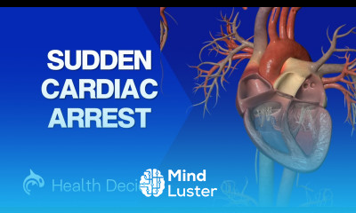 Cardiac Arrest Sudden Death 3D Animation