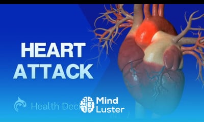Heart Attack Myocardial Infarction 3D Animation