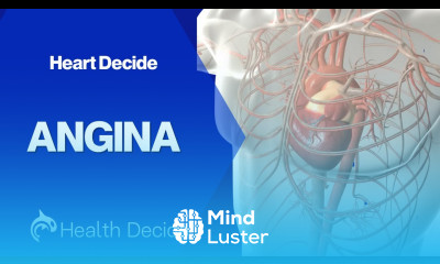 Angina 3D Animation