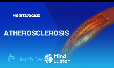 Atherosclerosis 3D Animation