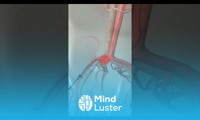 Learn How Cardiac Catheterization Works