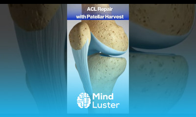 What Happens When You Tear Your ACL