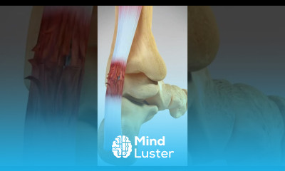 Can you name this Foot injury and procedure achilles achillestendonpain achillestendon