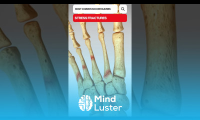 The Most Common Soccer Injuries 3D Animation