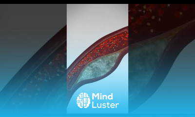 Did you know that Heart Attacks increase by 40 the last 2 weeks of the year