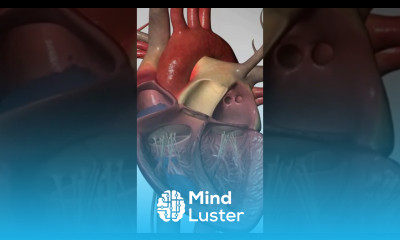 A Sudden Blow to the Chest cardiacarrest heartdisease heartattack ventricularfibrillation