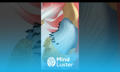 Open Surgery to Correct Hip Impingement Irregularly Shaped Femoral Head hippain hipinjury