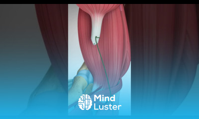 Distal Biceps Tendon Rupture and Repair bicepstendon elbowpain biceps