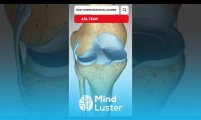 The Most Common Basketball Injuries 3D Animation basketball sports injuryrecovery anklesprain