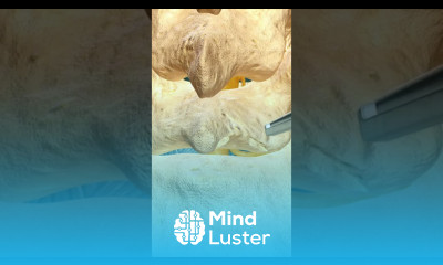 Say Goodbye To Low Back Pain With Lumbar Microdiscectomy