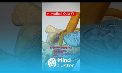 Can You Name This Medical Condition