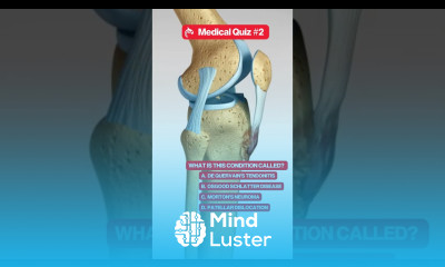 Can You Name This Medical Condition