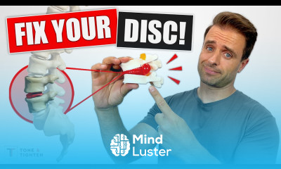 FIX YOUR DISC Bulging Disc Lower Back Exercises For Pain Relief