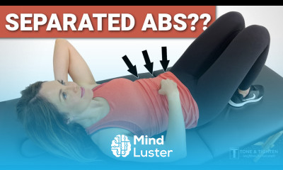 How To Check Diastasis Recti Abdominal Separation