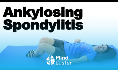 Ankylosing Spondylitis Stretches Exercises Ask Doctor Jo