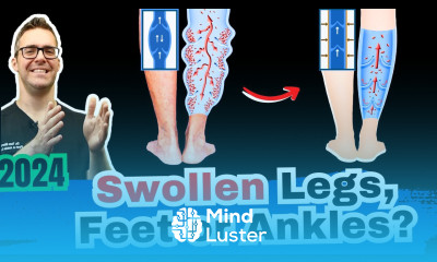 1 Cause of Swollen Ankles Legs or Feet What Causes It Dangers