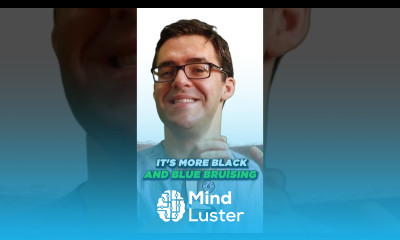 TWISTED Foot Injury swelling and pain in ANKLE