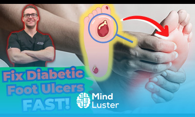 Diabetic Foot Ulcer Treatment Early Stages Diabetic Neuropathy